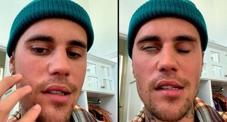 Justin Bieber yüz felci geçirdi
