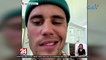 Justin Bieber, nag-cancel ng upcoming shows matapos maparalisa ang kalahati ng mukha dahil sa viral infection | 24 Oras Weekend