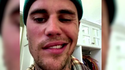 Justin Bieber annonce souffrir d’une paralysie au visage et annule ses prochains concerts