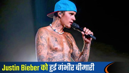 Justin Bieber को हुई Ramsay Hunt Syndrome नाम की गंभीर बीमारी, जानिए पूरी खबर