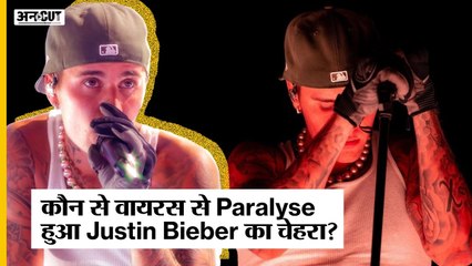 Justin Bieber का आधा चेहरा हुआ Paralyze, Concert Cancel होने से India Fans में फैली निराशा!