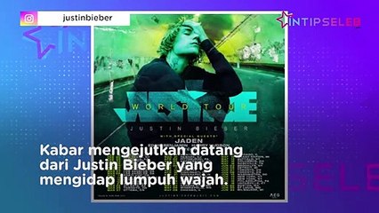 Justin Bieber Lumpuh, Gimana Nasib Konser Dunianya?