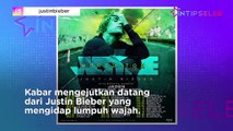 Justin Bieber Lumpuh, Gimana Nasib Konser Dunianya?