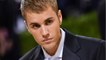 GALA VIDEO - Justin Bieber paralysé du visage : quel est le syndrome de Ramsay Hunt dont il souffre ?