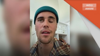 Ramsay Hunt | Justin Bieber alami kelumpuhan muka