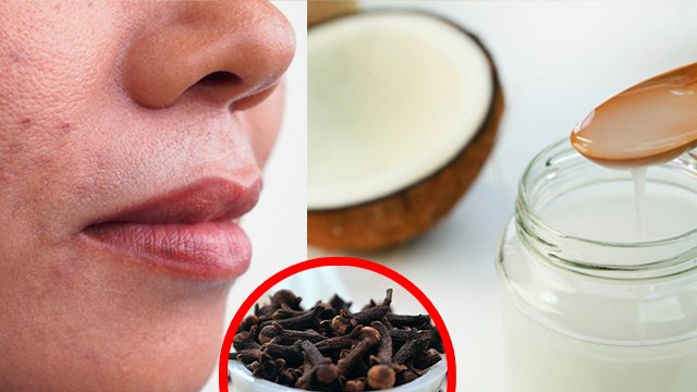 नारियल तेल का इस्तेमाल ये लोग भूलकर भी न करें । नारियल तेल के नुकसान । Boldsky । *Health