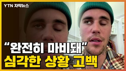 [자막뉴스] 저스틴, 비버 '심각한 근황' ...SNS에 영상 올리며 고백 / YTN