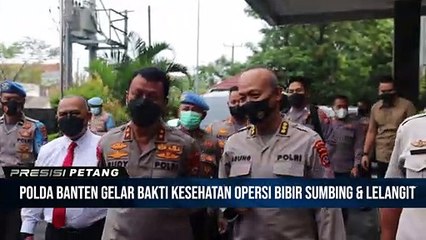 Polda Banten Gelar Operasi Bibir Sumbing dan Lelangit Gratis