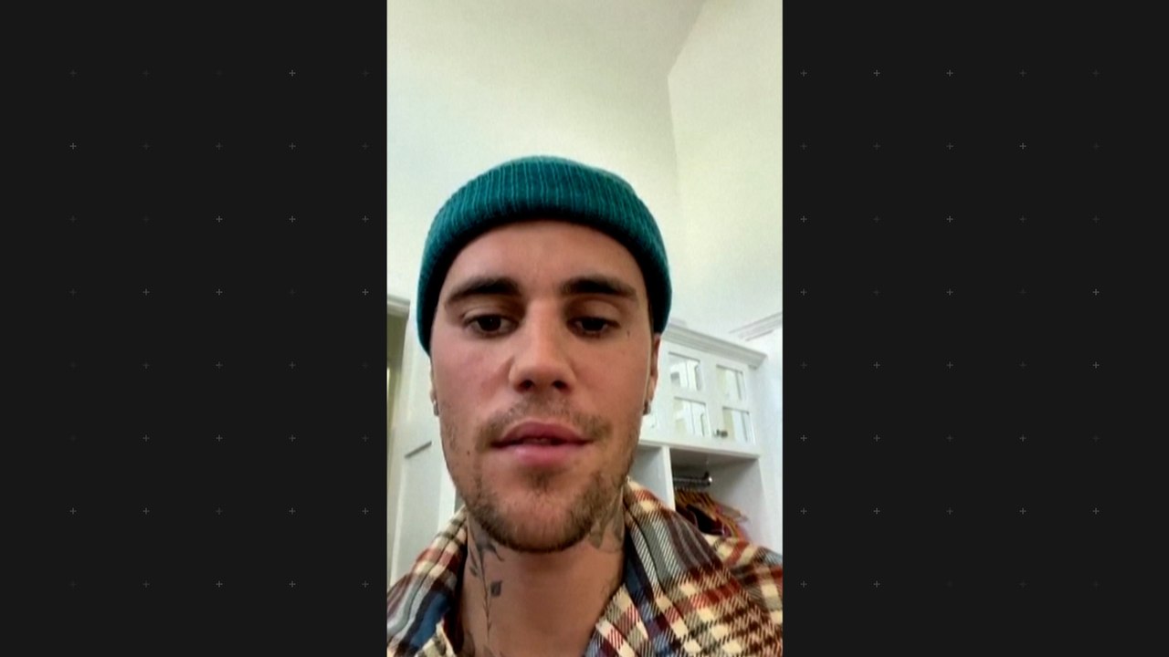 Justin Bieber über seine Krankheit: 'Eine Gesichtshälfte ist gelähmt'