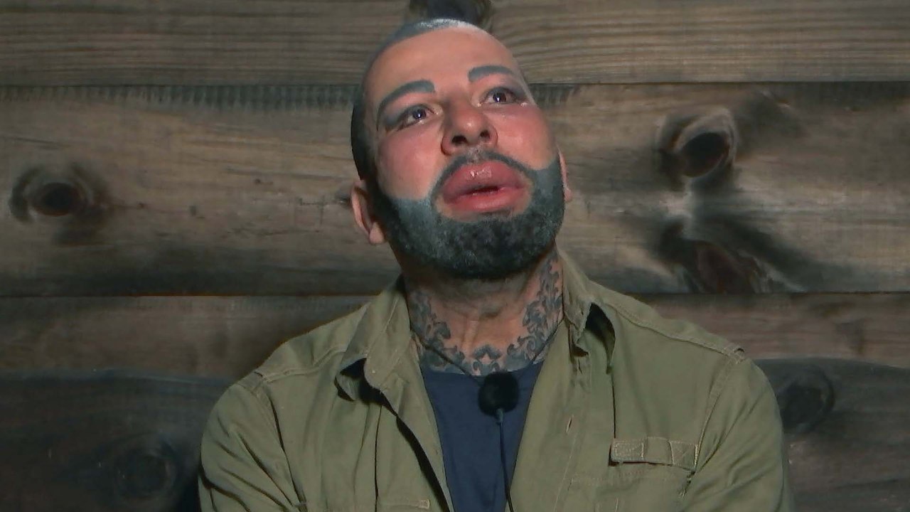 Dschungelcamp 2022: Harald Glööckler offenbart Eheprobleme