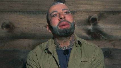 Dschungelcamp 2022: Harald Glööckler offenbart Eheprobleme