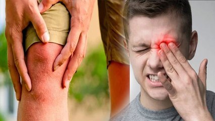 गठिया के लक्षण सिर्फ जोड़ो मे नहीं बल्कि आंखो में भी आते है नजर | Boldsky