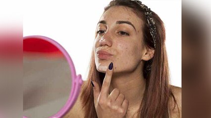 Periods के दौरान क्यो होते हैं Pimples | क्यों होते है Menstrual Acne, कैसें पाएं इनसे छुटकारा