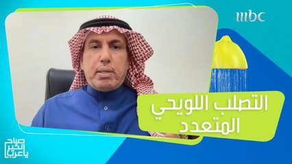 الأشخاص الأكثر عرضة للإصابة بالتصلب اللويحي المتعدد وطرق العلاج من المرض