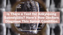 Is There a Test for Ankylosing Spondylitis? Here's How Doctors Diagnose This Spinal Condition