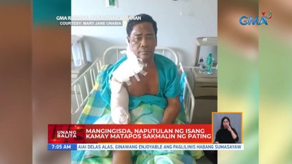 Mangingisda, naputulan ng isang kamay matapos sakmalin ng pating | UB