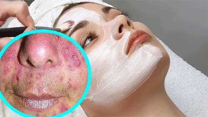 क्या आप भी Face पर Bleach लगाने के बाद करते ये Mistakes, पड़ सकता है भारी | Boldsky