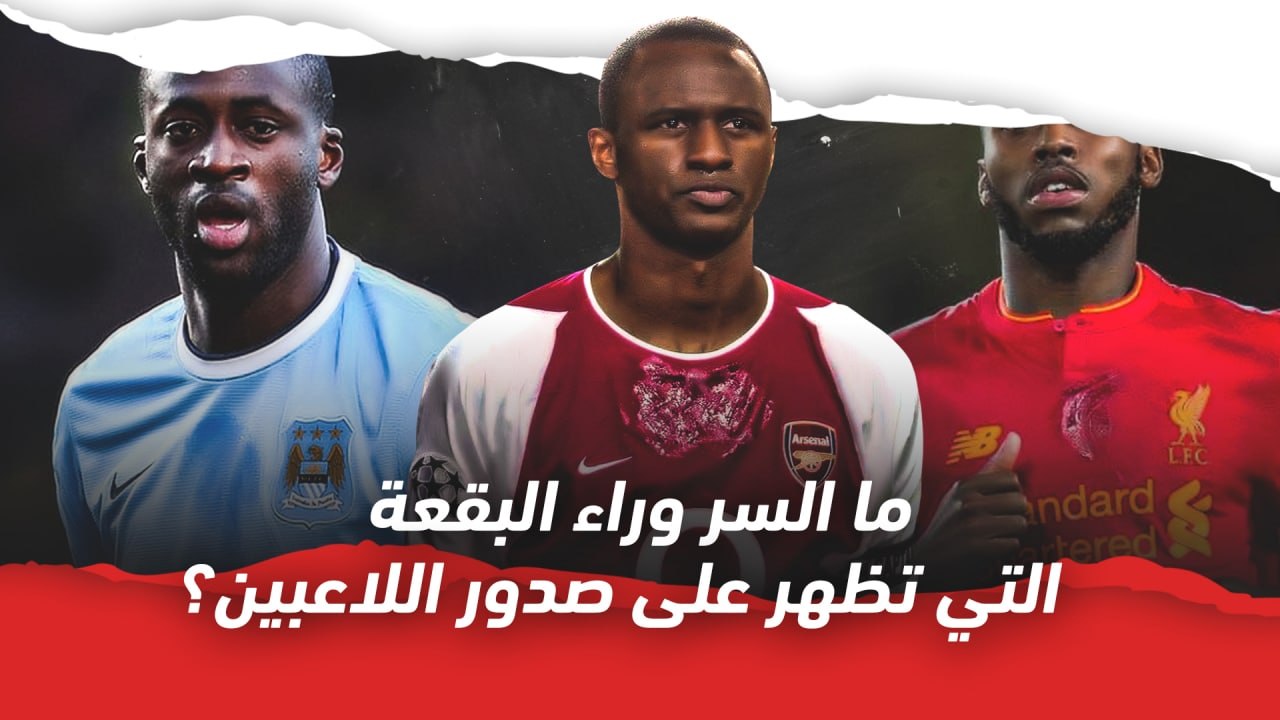 ما السر وراء البقعة التي تظهر على صدور اللاعبين