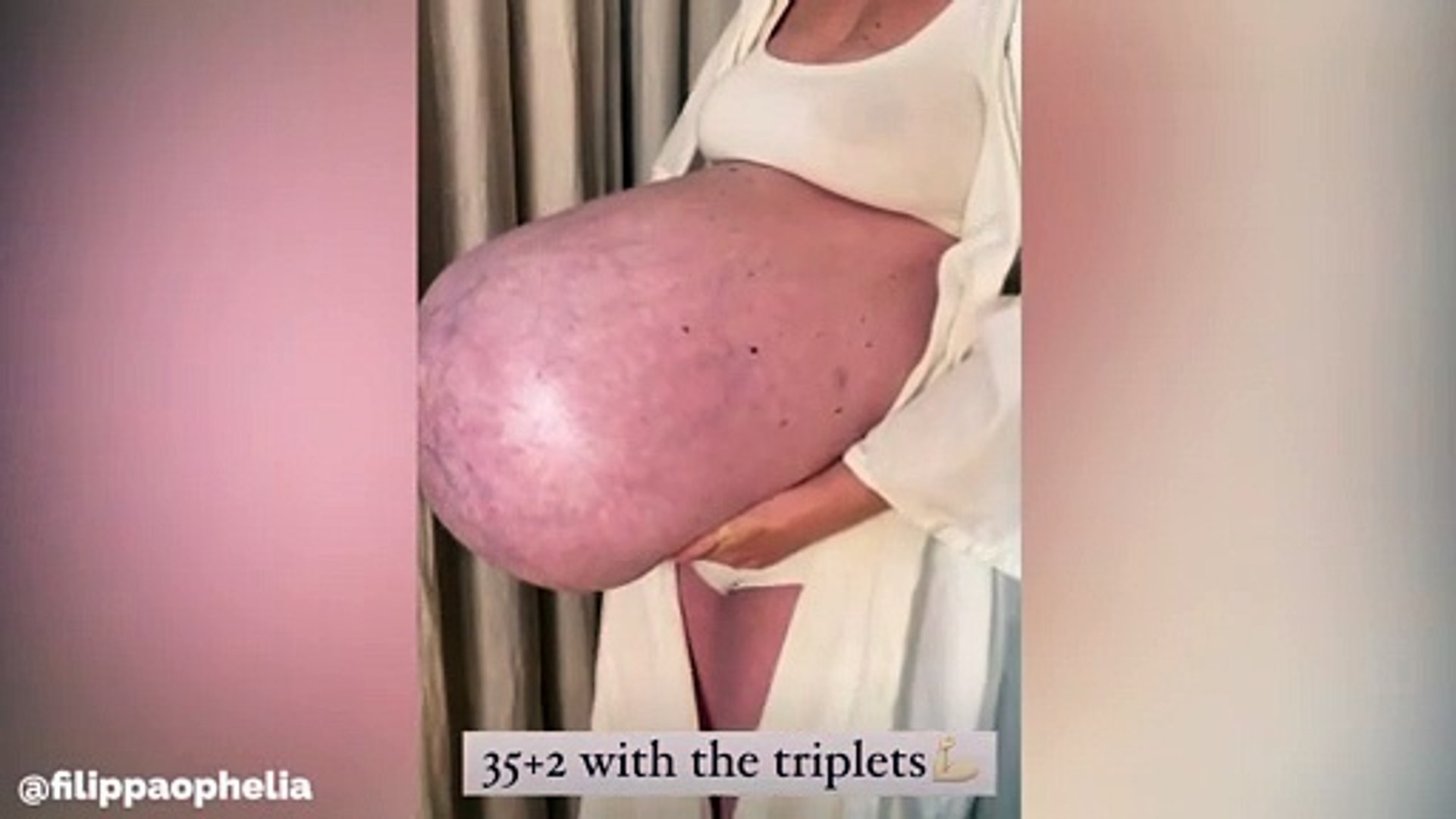 Le ventre de cette mère enceinte de triplés est spectaculaire - Vidéo  Dailymotion
