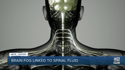 Brain fog linked to spinal fluid