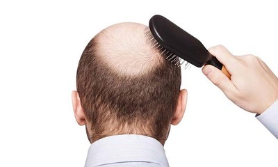 الرجل الأصلع أكثر نضجاً وذكاءً