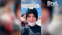 Lauryne, grande brulée raconte son quotidien sur TikTok