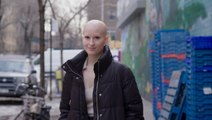 Will My Blind Date Mind That I'm Bald? | DATING DIFFERENT