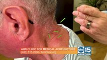 Got a pain in the neck? Doctor Yang Ahn treats chronic cervical pain using medical acupuncture