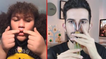 Uzmanlar "evde estetik" akımına karşı gençleri uyarıyor: 72 saat içinde müdahale edilmezse hasarı kalıcı olur