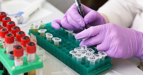 Un vaccin contre le sida grâce à la technologie de l'ARN messager ? La première phase de test est en cours