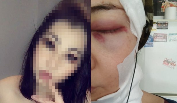 Otel odasında dehşetin sırrı! Otele giriş anları kameraya yansıdı