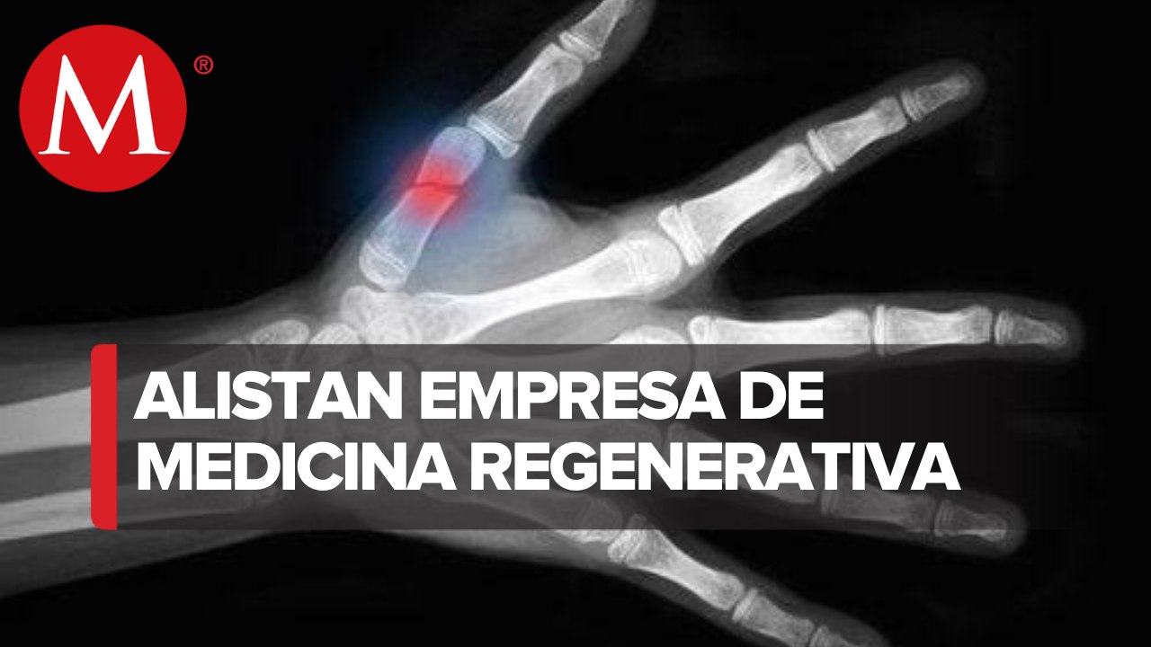 México abrirá primera empresa especializada en restructuración de huesos y tejidos