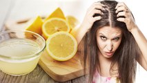 Hair में नींबू का रस लगाने पहले जरूर देखे Video, Scalp Infection से  लेकर Hair fall का खतरा| Boldsky
