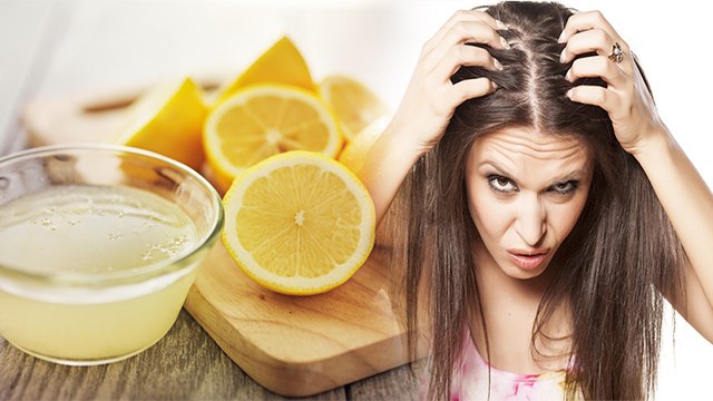 Hair में नींबू का रस लगाने पहले जरूर देखे Video, Scalp Infection से लेकर Hair fall का खतरा| Boldsky