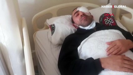 İstanbul'da kameramanı kör eden yumruk!