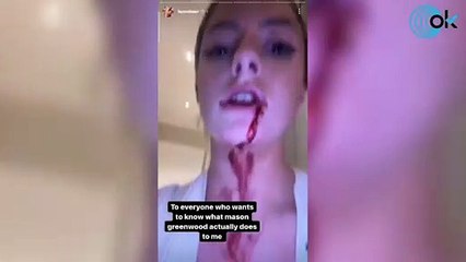 Detienen a Greenwood acusado de dar una paliza y violar a su novia