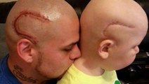 Il se fait tatouer la même cicatrice que son fils atteint d'un cancer