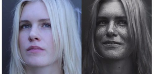 L'artiste Thomas Leveritt montre les dégâts causés par le soleil sur la peau dans une vidéo