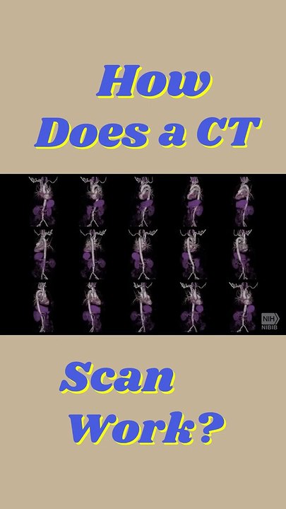 y2mate.com - How Does a CT Scan Work   CT Scan Working_1080p