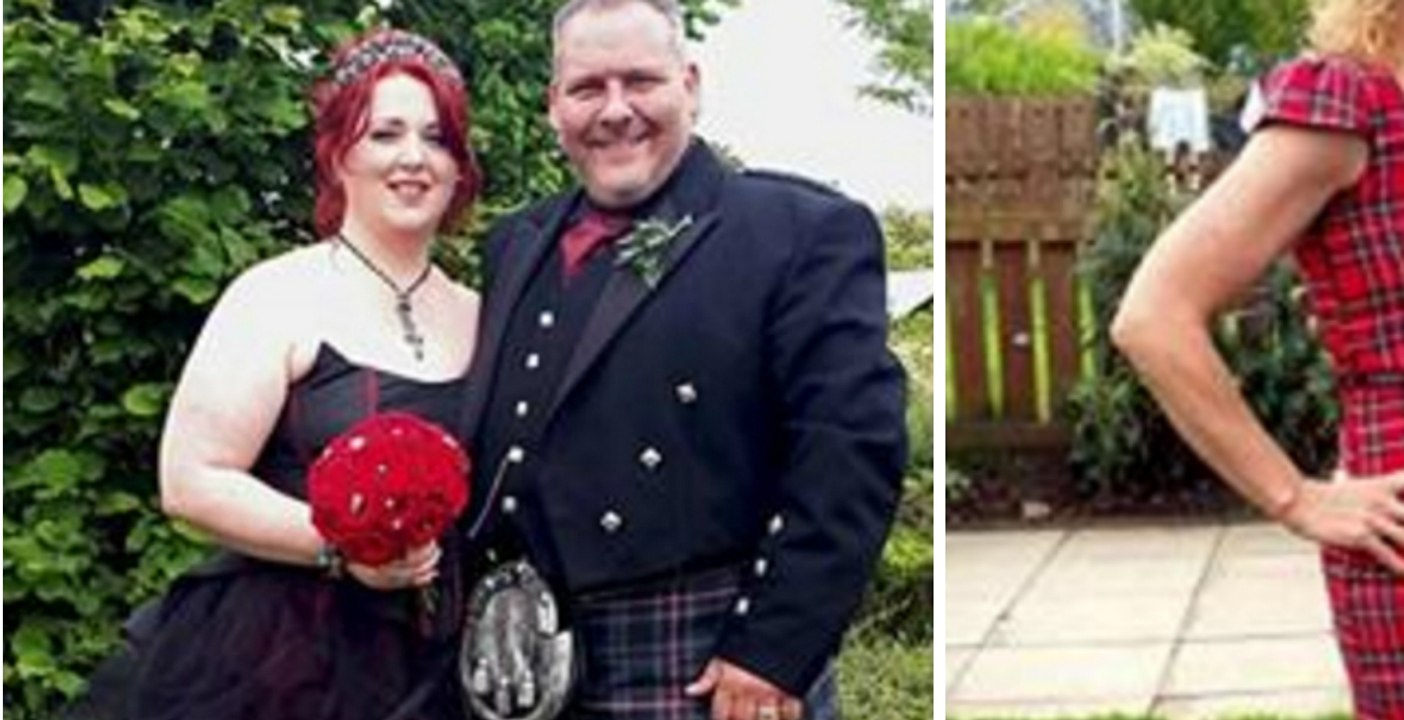 Mark et Louise Hannigan, le couple d'obèses qui perd plusieurs kilos en quelques semaines. Le résultat est incroyable