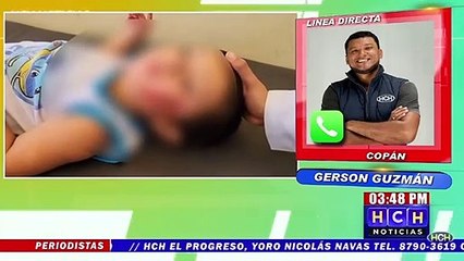 Embravecido perro le desfigura rostro a niño de 2 años en La Entrada, Copán