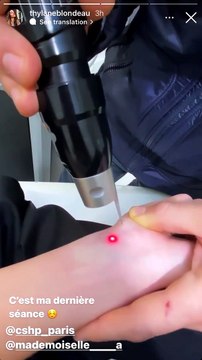 Thylane Blondeau s'est fait retirer un tatouage au laser à l'institut CSHP Paris. Story Instagram.