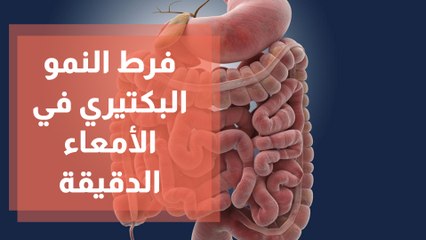 فرط النمو البكتيري في الأمعاء الدقيقة