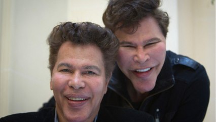 FEMME ACTUELLE - Igor et Grichka Bogdanoff : pourquoi ils ont voulu allonger leur menton