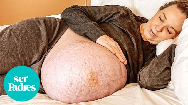 La impresionante tripa de una mujer embarazada de trillizos