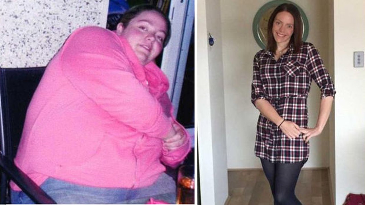Nachdem sie fast 100 Kilo abgespeckt hat, zeigt sie die Folgeerscheinungen der Diät auf ihren Körper.