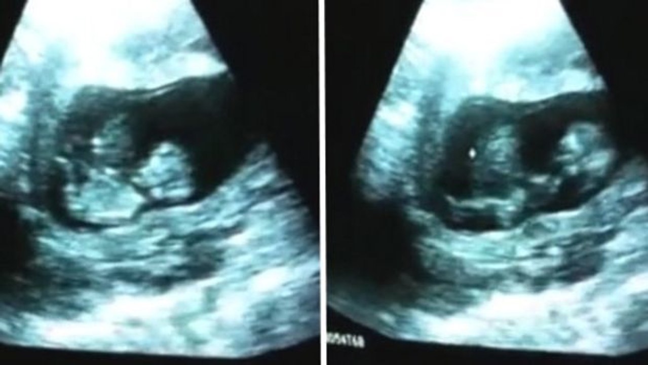 Was macht denn dieses Baby Komisches im Bauch seiner Mama?