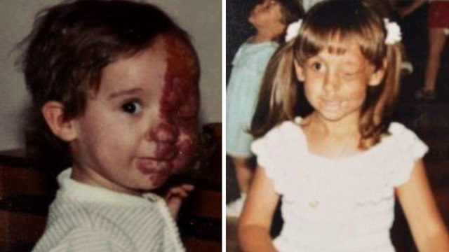 Seit der Kindheit wegen eines Tumors im Gesicht entstellt, nimmt sie sich ihre Wiedergutmachung am Leben.