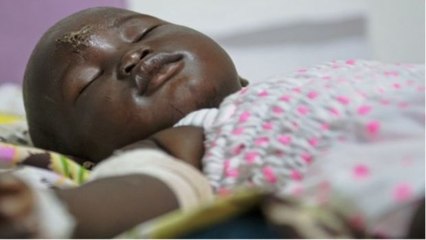 Dreizehn Monate altes Baby überlebt Flugzeugabsturz wie durch ein Wunder.