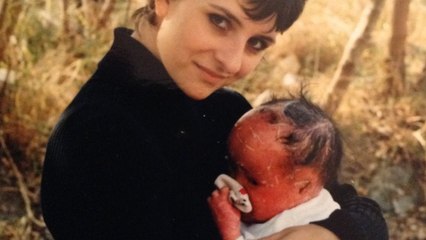 Das sogenannte Harlekin-Kind Mui Thomas leidet an Ichthyose, einer sehr seltenen Hautkrankheit.